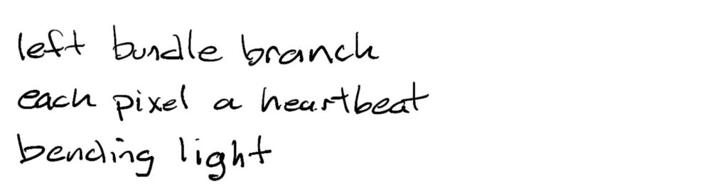 Haiku; left bundle branch / each pixel, a heartbeat / bending light